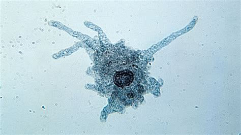  Amoeba! Uma Jornada Microscópica Através do Mundo das Célula Unicelulares