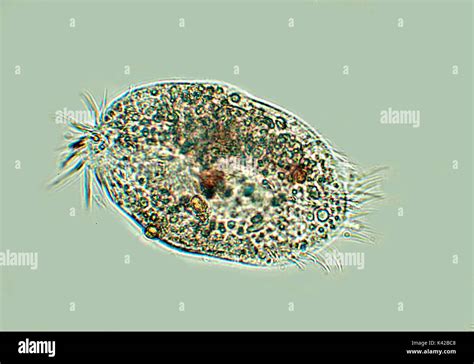  Glossentylis! Uma Jornada Microscópica Através da Intrincada Beleza dos Ciliados